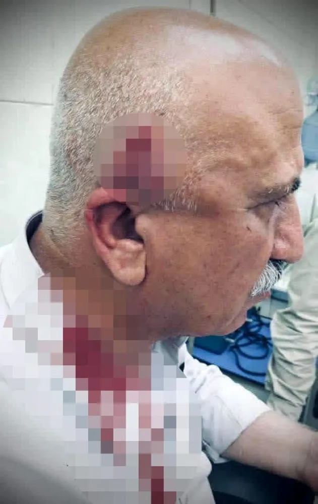 Kerkük'te Kaymakama Saldırı - Son Dakika