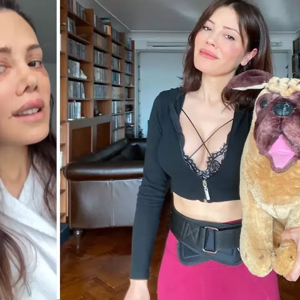 Didem Ceran, Yüz Estetiği Sonrası 19 Gündür Banyo Yapmadığını Paylaştı